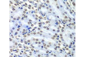 Immunohistochemistry of paraffin-embedded Mouse kidney using SEPT7 Polyclonal Antibody at dilution of 1:100 (40x lens).