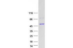Validation with Western Blot