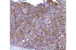 IHC analysis of AGPS using anti-AGPS antibody (ABIN7600146). (AGPS anticorps  (AA 154-658))