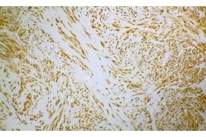 Image no. 1 for anti-Desmin (DES) antibody (ABIN335365) (Desmin anticorps)