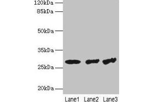 Western blot All lanes: TBCB antibody at 4 μg/mL Lane 1: Hela whole cell lysate Lane 2: A549 whole cell lysate Lane 3: Jurkat whole cell lysate Secondary Goat polyclonal to rabbit IgG at 1/10000 dilution Predicted band size: 28, 22 kDa Observed band size: 28 kDa (TBCB anticorps  (AA 1-244))