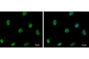 ICC/IF Image CSE1L antibody detects CSE1L protein at nucleus by immunofluorescent analysis.