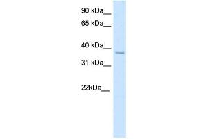 SFPI1 antibody (20R-1184) used at 0. (SPI1 anticorps  (N-Term))
