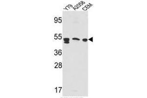 Western blot analysis of SAP Antibody (Center E300) in Y79,A2058,CEM cell line lysates(35ug/lane). (Prosaposin anticorps  (Middle Region))