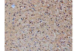 IHC analysis of PPP2CA using anti-PPP2CA antibody (ABIN3043356). (PPP2CA anticorps  (AA 1-309))