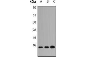 Western blot analysis of Profilin 1 expression in HT29 (A), PC12 (B), COS7 (C) whole cell lysates. (PFN1 anticorps)
