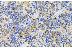 Immunohistochemistry of paraffin-embedded Mouse spleen using TREM2 Polyclonal Antibody at dilution of 1:200 (40x lens). (TREM2 anticorps)