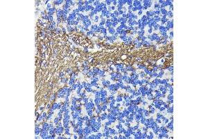 Immunohistochemistry of paraffin-embedded mouse cerebellum using CNPase Rabbit mAb (ABIN7265322) at dilution of 1:100 (40x lens). (Cnpase anticorps)