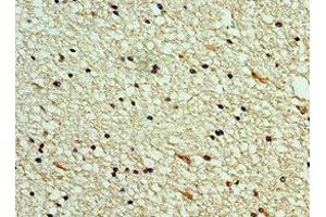 Immunohistochemistry of paraffin-embedded human brain tissue using ABIN7146050 at dilution of 1:100 (CLEC11A anticorps  (AA 22-323))