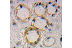 Used in DAB staining on fromalin fixed paraffin-embedded Kidney tissue (Endoglin anticorps  (AA 336-450))