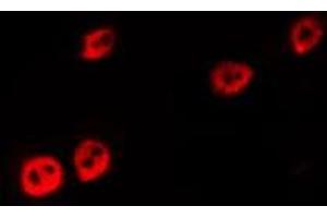 ABIN6267292 staining MDA-MB-435 by IF/ICC.