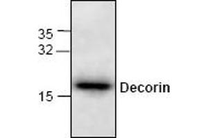 Image no. 1 for anti-Decorin (DCN) antibody (ABIN264841) (Decorin anticorps)
