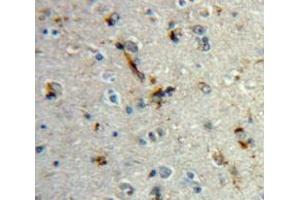 IHC-P analysis of Brain tissue, with DAB staining. (MBP anticorps  (AA 18-222))