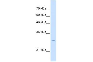 WB Suggested Anti-TSPAN32 Antibody Titration:  2. (TSPAN32 anticorps  (Middle Region))
