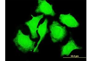 Immunofluorescence of monoclonal antibody to TCL1A on HeLa cell.