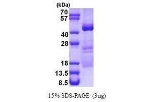 Figure annotation denotes ug of protein loaded and % gel used. (OBFC1 Protéine)