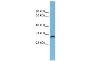 Image no. 1 for anti-Steroid-5-alpha-Reductase, alpha Polypeptide 2 (3-Oxo-5 alpha-Steroid delta 4-Dehydrogenase alpha 2) (SRD5A2) (AA 35-84) antibody (ABIN6744768)
