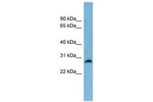 Image no. 1 for anti-Steroid-5-alpha-Reductase, alpha Polypeptide 2 (3-Oxo-5 alpha-Steroid delta 4-Dehydrogenase alpha 2) (SRD5A2) (AA 35-84) antibody (ABIN6744768) (SRD5A2 anticorps  (AA 35-84))