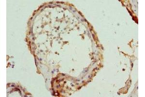 Immunohistochemistry of paraffin-embedded human testis tissue using ABIN7171417 at dilution of 1:100