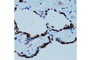 Immunohistochemistry of paraffin-embedded human lung using CTSE antibody (ABIN5971444) at dilution of 1/100 (40x lens). (Cathepsin E anticorps)