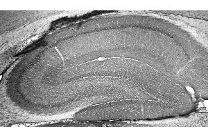 Adult rat hippocampus immunohistochemistry. (ATAD1 anticorps  (AA 1-361))