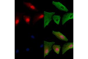 ABIN6256826 and ABIN6273479 staining  cells by IF/ICC.