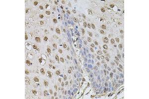 Immunohistochemistry of paraffin-embedded human esophagus using CCNA2 antibody (ABIN1871532) at dilution of 1:100 (40x lens). (Cyclin A anticorps)