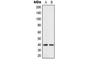 Western blot analysis of ABHD12B expression in human brain (A), K562 (B) whole cell lysates. (ABHD12B anticorps  (C-Term))