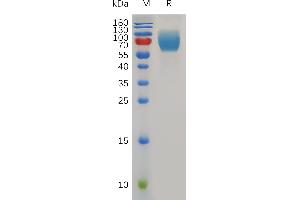 Mouse B7-2 Protein, hFc Tag on SDS-PAGE under reducing condition.