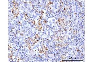 IHC analysis of UBXN8 using anti-UBXN8 antibody (ABIN7600091).