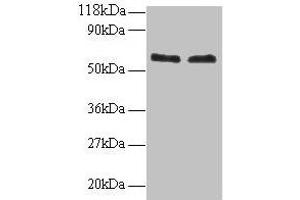 Western blot All lanes: FUS antibody at 2 μg/mL Lane 1: 293T whole cell lysate Lane 2: EC109 whole cell lysate Secondary Goat polyclonal to rabbit IgG at 1/15000 dilution Predicted band size: 54 kDa Observed band size: 60 kDa (FUS anticorps  (AA 1-198))