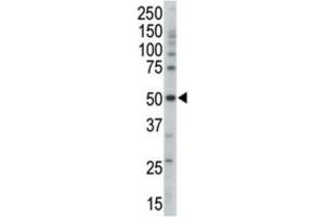 Western Blotting (WB) image for anti-Protein Kinase, AMP-Activated, gamma 3 Non-Catalytic Subunit (PRKAG3) antibody (ABIN3002961)