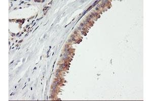 Immunohistochemical staining of paraffin-embedded Human breast tissue using anti-ENPEP mouse monoclonal antibody. (ENPEP anticorps)