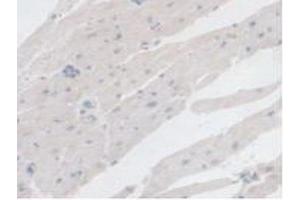 Detection of BCKDK in Rat Heart Tissue using Polyclonal Antibody to Branched Chain Alpha-Ketoacid Dehydrogenase Kinase (BCKDK) (BCKDK anticorps  (AA 44-223))