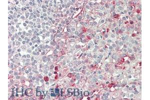 IHC-P analysis of Human Spleen Tissue, with HE staining. (CD86 anticorps  (AA 46-282))