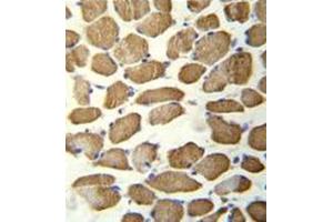 Immunohistochemistry analysis in formalin fixed and paraffin embedded human skeletal muscle reacted with hCG_1645727 Antibody (C-term) followed by peroxidase conjugation of the secondary antibody and DAB staining. (KBTBD13 anticorps  (C-Term))