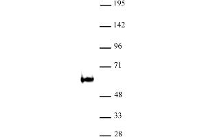 TDG / Thymine-DNA glycosylase antibody (pAb) tested by Western blot Nuclear extract of P19 cells (30 μg) probed with TDG / Thymine-DNA glycosylase antibody (1:500). (TDG anticorps)