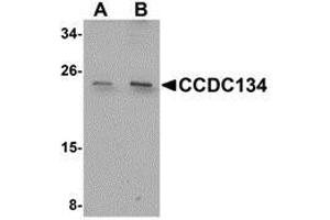 Western blot analysis of CCDC134 in rat brain tissue lysate with AP30210PU-N CCDC134 antibody at (A) 1 and (B) 2 μg/ml.