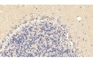 Detection of SEMA5B in Human Cerebellum Tissue using Polyclonal Antibody to Semaphorin 5B (SEMA5B)