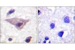 Immunohistochemistry analysis of paraffin-embedded human brain, using Synuclein (Phospho-Ser129) Antibody. (Synuclein anticorps  (pSer129))