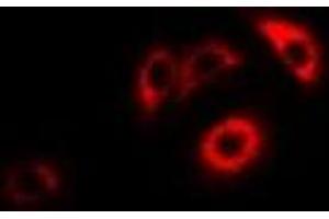 Immunofluorescent analysis of ERp46 staining in HepG2 cells. (TXNDC5 anticorps)