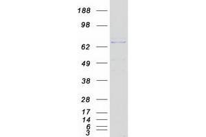 Validation with Western Blot