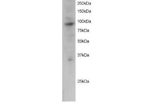 Image no. 1 for anti-PML-RARA Regulated Adaptor Molecule 1 (PRAM1) (C-Term) antibody (ABIN374107) (PRAM1 anticorps  (C-Term))