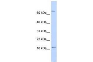 Image no. 1 for anti-Nuclear Receptor 2C2-Associated Protein (NR2C2AP) (N-Term) antibody (ABIN6741243) (NR2C2AP anticorps  (N-Term))