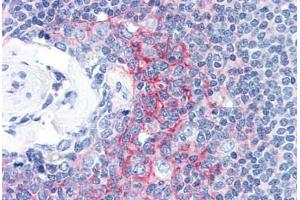 Human Spleen (formalin-fixed, paraffin-embedded) stained with ICAM1 antibody ABIN337366 at 10 ug/ml followed by biotinylated anti-mouse IgG secondary antibody ABIN481714, alkaline phosphatase-streptavidin and chromogen. (ICAM1 anticorps)
