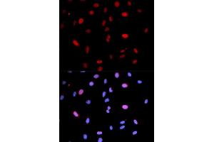 Immunofluorescence (IF) image for anti-Mitogen-Activated Protein Kinase Kinase 6 (MAP2K6) (pSer207) antibody (ABIN1870360) (MAP2K6 anticorps  (pSer207))