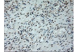 Immunohistochemical staining of paraffin-embedded lung tissue using anti-L1CAMmouse monoclonal antibody. (L1CAM anticorps)