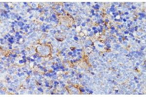 Immunohistochemistry of paraffin-embedded Mouse spleen using SNAP23 Polyclonal Antibody at dilution of 1:100 (40x lens). (SNAP23 anticorps)