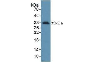 Detection of Recombinant KLK2, Human using Monoclonal Antibody to Kallikrein 2 (KLK2) (Kallikrein 2 anticorps  (AA 19-261))