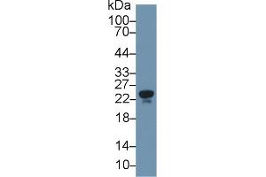 Detection of APOM in Human Serum using Polyclonal Antibody to Apolipoprotein M (APOM)